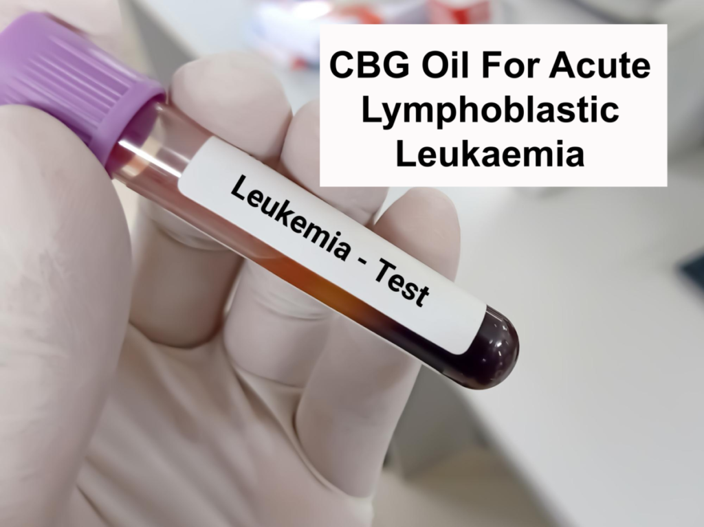 CBG Oil For Acute Lymphoblastic Leukaemia
