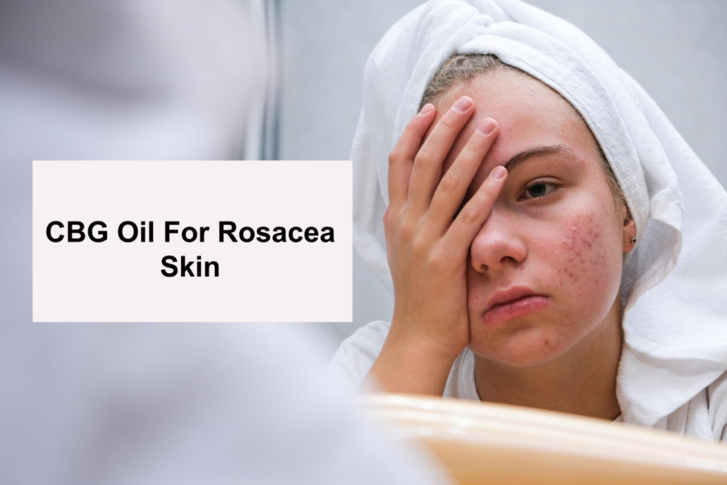CBG Oil For Rosacea Skin